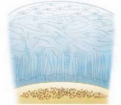 Illustration of autograft plug transfer - Dr. Mohammed Hutaif