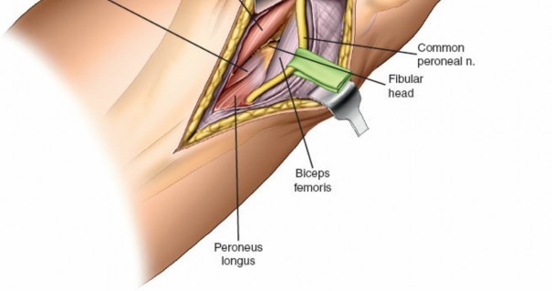 Illustration 31 for Surgical Access: Mastering the Tibia's Surface & Fibula Approaches