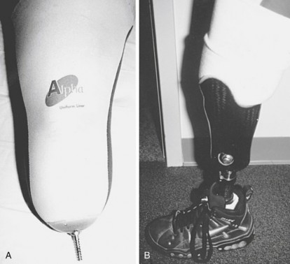 نظام تعليق البطانة الهلامية تحت الركبة مع دبوس قفل معدني