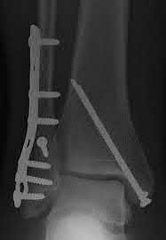Illustration 8 for OrthoCash: Trauma MCQs & Cases for a yearold woman