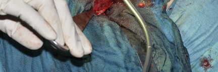 Illustration 36 for Collum Femoris Preserving: Achieve Better Primary Hip Outcomes