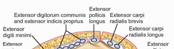 Distal Radius Fixation: Precision Through Lister's Tubercle