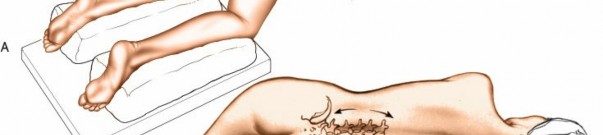 Illustration 4 for Approach to the Lumbar Spine: Mastering Techniques & Anatomy