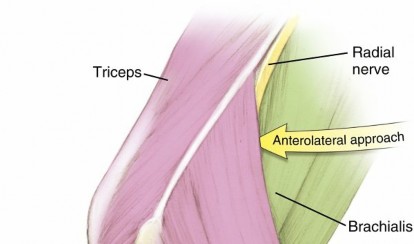 Illustration of miller md et - Dr. Mohammed Hutaif