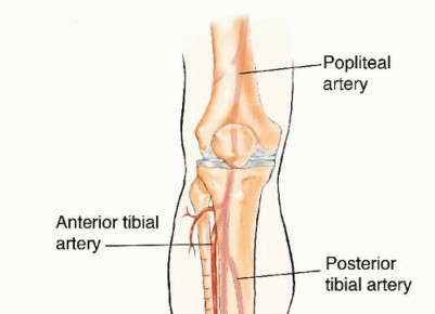 The Use of Free Vascularized Fibular Grafts for Reconstruction of Segmental Bone Defects