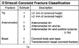 Illustration 6 for Complex Elbow Dislocation: Demystifying the Posteromedial Case
