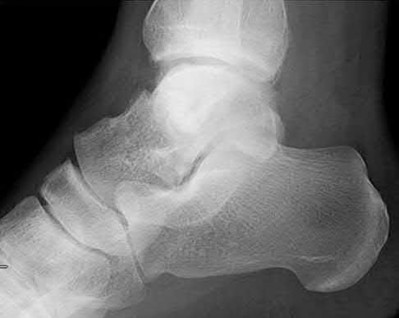 Illustration 156 for OrthoCash: Trauma MCQs & Cases for a yearold woman