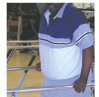 Illustration 34 for Mastering Hip Disarticulation: Through the Hip Joint Capsule