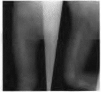 Orthopedic Pediatric Review | Dr Hutaif Pediatric Ortho -...