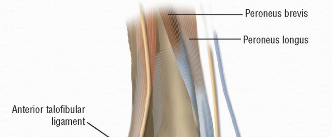 Effective Instability Anatomic Repair: End Chronic Ankle Pain