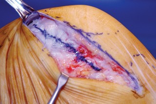 وصف طبي دقيق للمريض