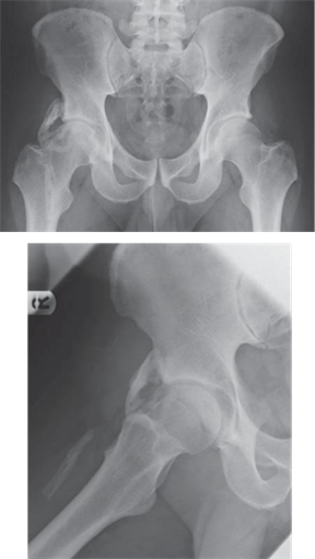 Illustration 16 for Ace FRCS Orthopaedics: Oxford University Press Adult Pathology Viva
