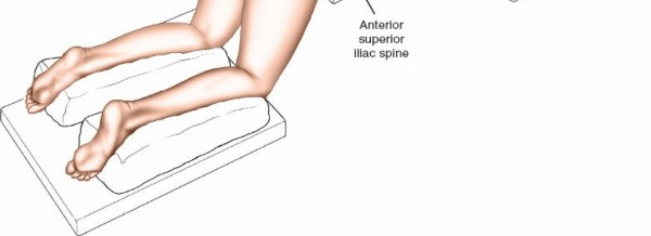 Illustration 344 for Approach to the Lumbar Spine: Mastering Techniques & Anatomy