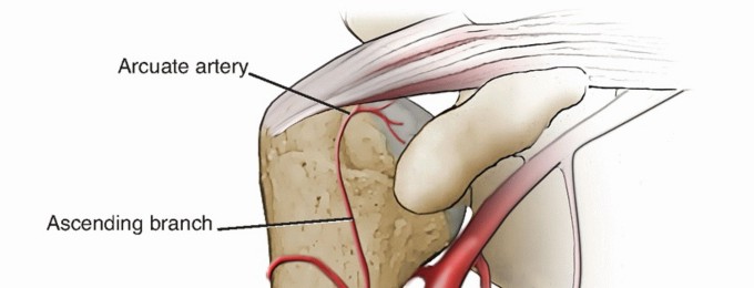 Optimizing Greater Tuberosity Sutures in RSA Outcomes