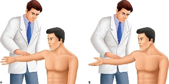 Illustration of cases slap tear - Dr. Mohammed Hutaif