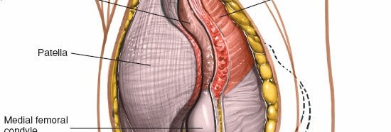 Illustration 36 for Mastering Knee Approaches: Spotlight on Superficial Medial Ligament