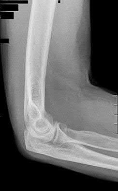 Illustration 76 for OrthoCash: Trauma MCQs & Cases for a yearold woman