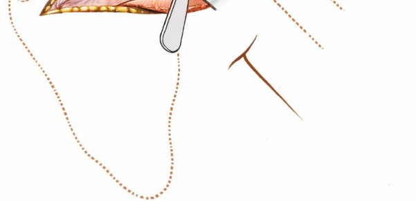 Illustration 178 for Essential Guide: Mastering Every Approach to the Shoulder