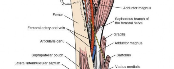 Illustration 113 for Optimal Femoral Approaches: Mastering the Lateral Intermuscular Septum