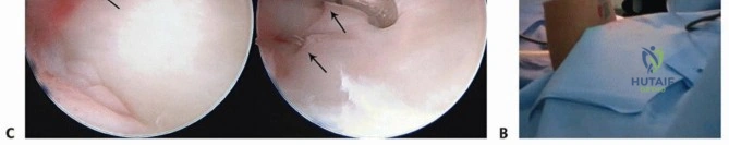 Advanced Insights into Plantar Fasciitis & Persistent Heel Pain: Etiology, Anatomy, & Differential Diagnosis