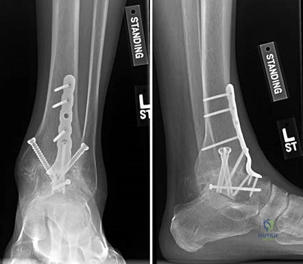Clinical Image
