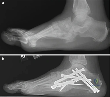 Clinical Image