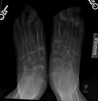 Clinical Image