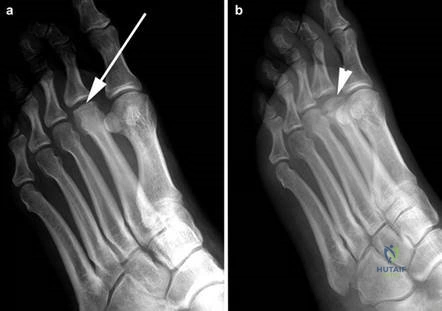 Clinical Image