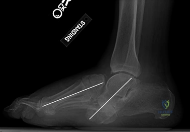 Clinical Image