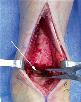 Clinical Image