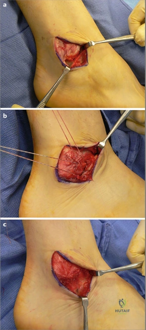 Clinical Image