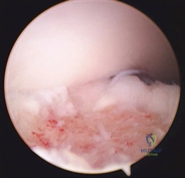 Clinical Image
