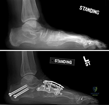 Clinical Image