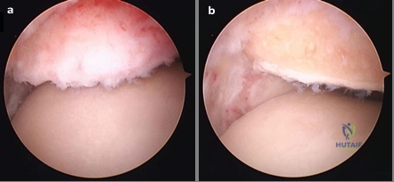 Clinical Image