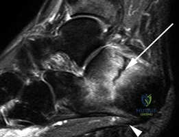 Clinical Image
