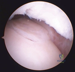 Clinical Image