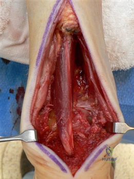 Clinical Image