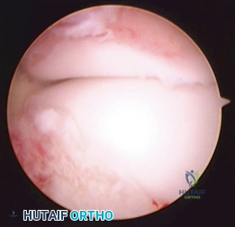 Clinical Image