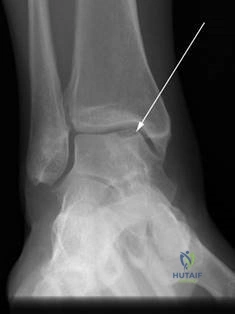 Clinical Image