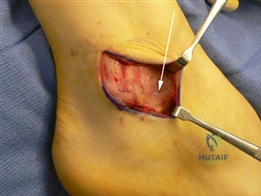 Clinical Image