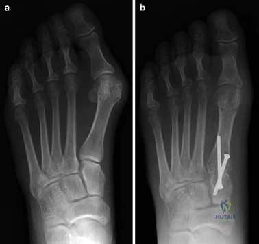 Clinical Image