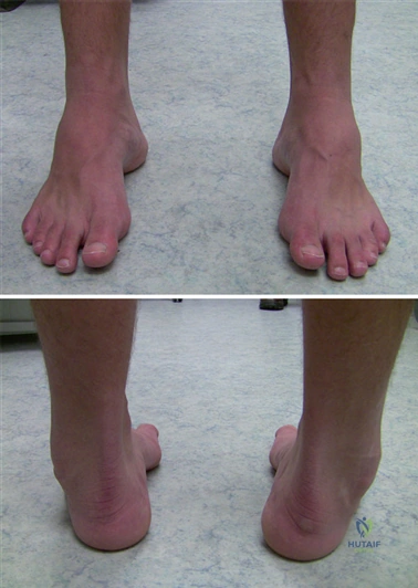 Clinical Image
