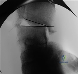 Clinical Image