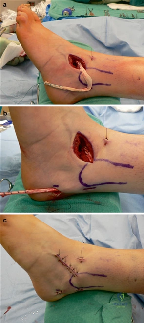 Clinical Image