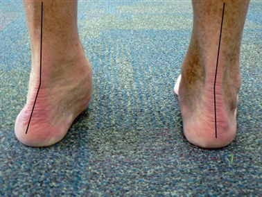 Clinical Image