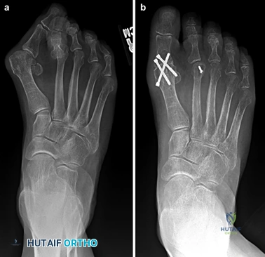 Clinical Image