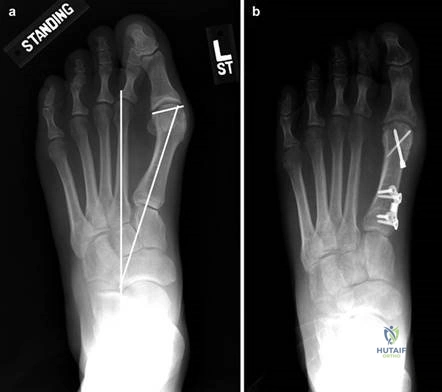 Clinical Image