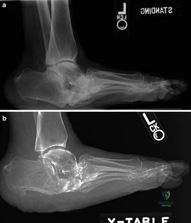 Clinical Image