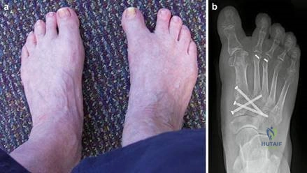 Clinical Image