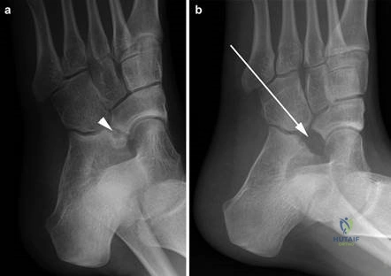 Clinical Image